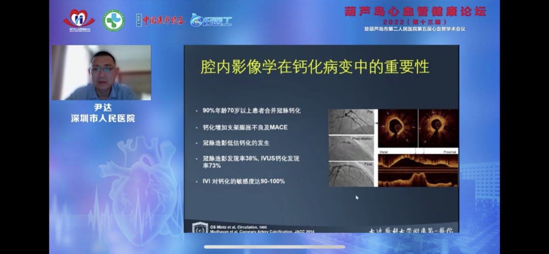 葫蘆島心血管健康論壇?2022｜創(chuàng)新驅(qū)動發(fā)展，不斷提升心血管疾病救治能力(圖11)